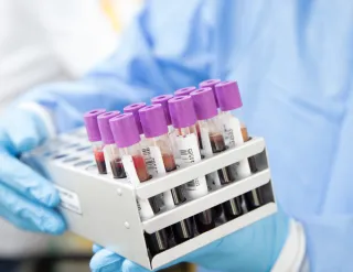 Normal Labs, Optimal Health, and Why Your Numbers Need Context