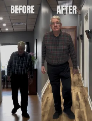 Hip Pain After Hip Replacement: Why It Happens and What Treatment Options May Help