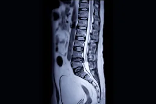 Your MRI Doesn't Paint The Picture