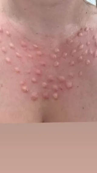 Chest Skin Boosters: Hydration, Texture and Consultation Questions