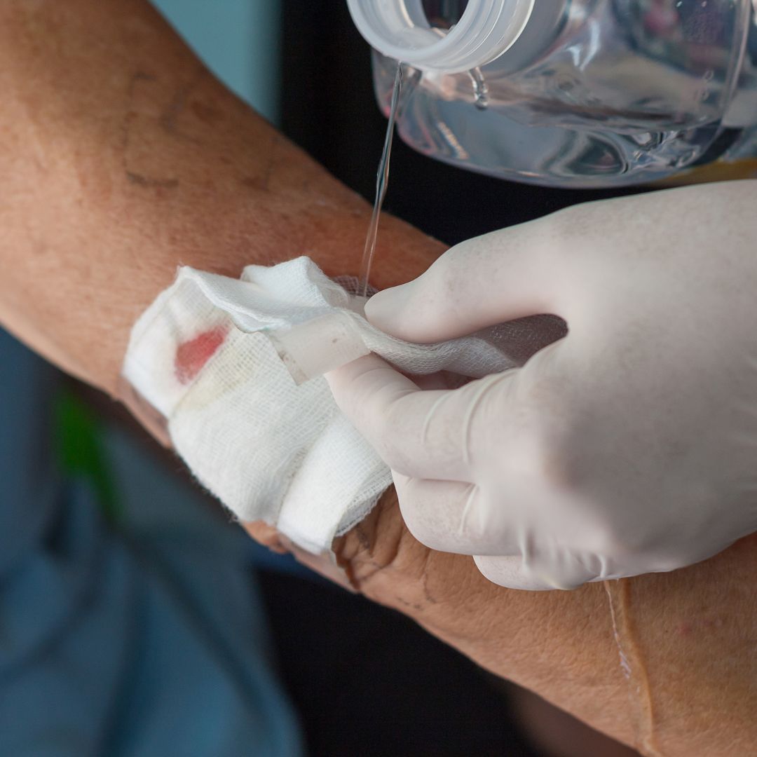 What Are the 4 Types of Wound Drainage? Knowing What They Mean