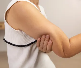 Felkarplasztika (brachioplasztika): feszesebb karok, fiatalosabb megjelenés