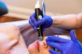 Ensuring Safety and Efficacy in Laser Treatments