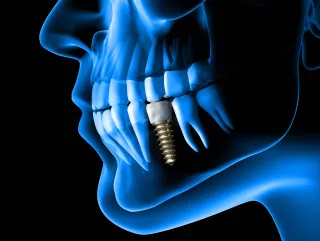 Common Orthodontic Problems and Treatment Options in Langhorne, PA