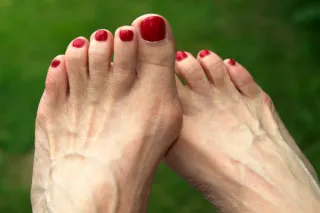 Are Bunions Hereditary, or Are Your Shoes to Blame? | Plymouth Podiatry