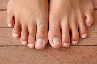 What Your Toenails Could Be Telling You About Your Foot Health