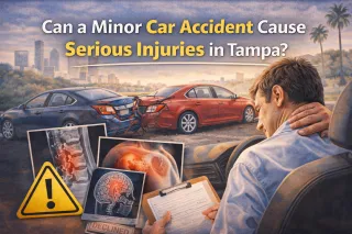 Can a Minor Car Accident Cause Serious Injuries in Tampa?