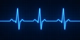 Atrial Fibrillation and Stroke