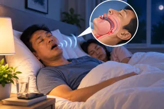 Sleep Apnoea After a Stroke
