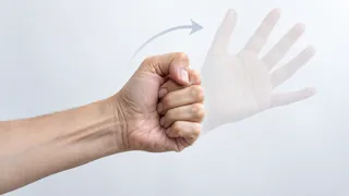 Why Can't I Open My Hand After a Stroke?