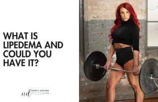 What Is Lipedema and Could You Have It?