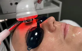 Skin Resurfacing Before And After: See Your Transformation