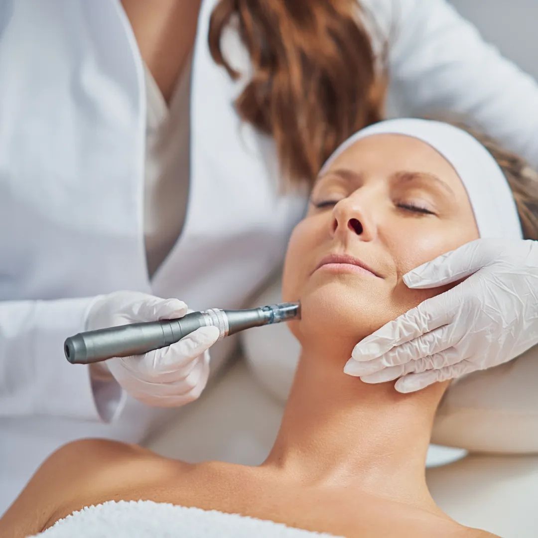 PRP vs Microneedling in Greenwood, IN | How to Choose the Right Treatment