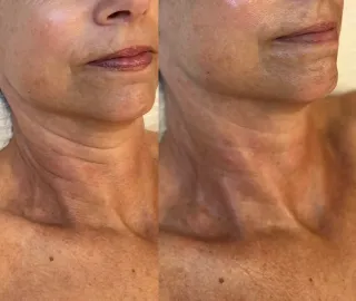 The Science of the "Snatched" Glow