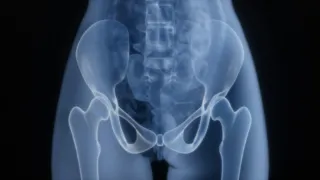 Why Medical Doctors Can Miss Male Pelvic Floor Problems