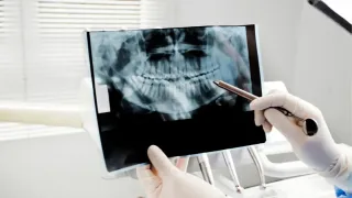 Understanding Dental X-Rays: Types and Why They Matter