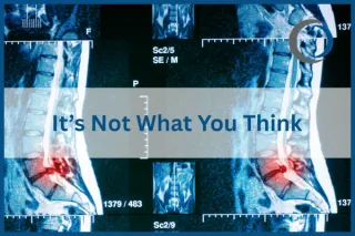 Neurological Reasons for Chronic Back Pain | Cruz Country