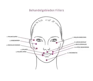 Fillers in Hasselt: volume en contour op een natuurlijke manier
