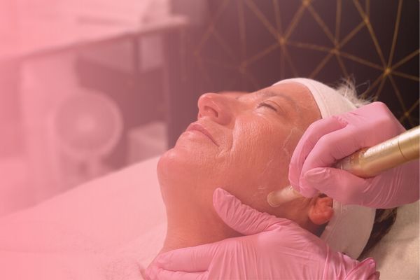 Microneedling: What to Expect