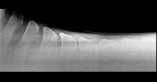 My Horse Has Kissing Spine — What Do I Do Now?
