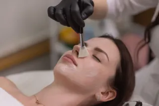 Unlock the Secrets of Radiant Skin with Chemical Peels