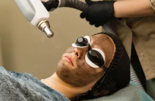 7 Reasons a Carbon Facial Should Be Your Next Skincare Service