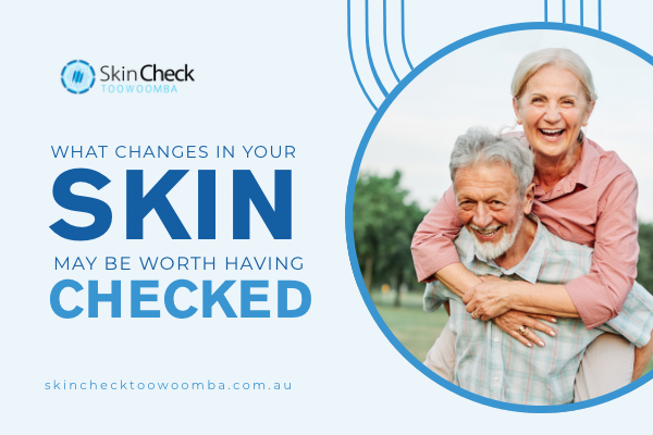 What Changes in Your Skin May Be Worth Having Checked