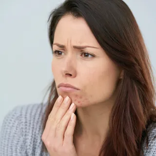 Hormonal Acne on Your Jawline in Your 30s? Here's What Your Skin Could Be Trying to Tell You
