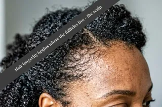 Why Do Edges Thin First? Understanding Tension, Follicle Sensitivity, and Hair Retention