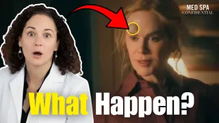 What Nicole Kidman's Face Is Telling You About Fillers