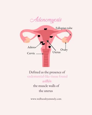 Adenomyosis: Symptoms, Causes, Risk Factors & Natural Pain Relief Options