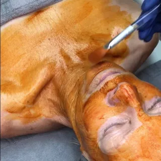 How Do I Care for My Skin After a Facial?