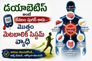 డయాబెటిస్ అంటే కేవలం షుగర్ కాదు – మొత్తం మెటబాలిక్ సిస్టమ్‌ వ్యాధి