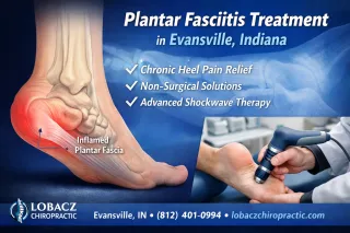 Shockwave Therapy for Plantar Fasciitis