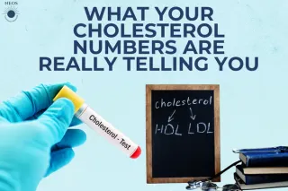 What Your Cholesterol Numbers Are Really Telling You