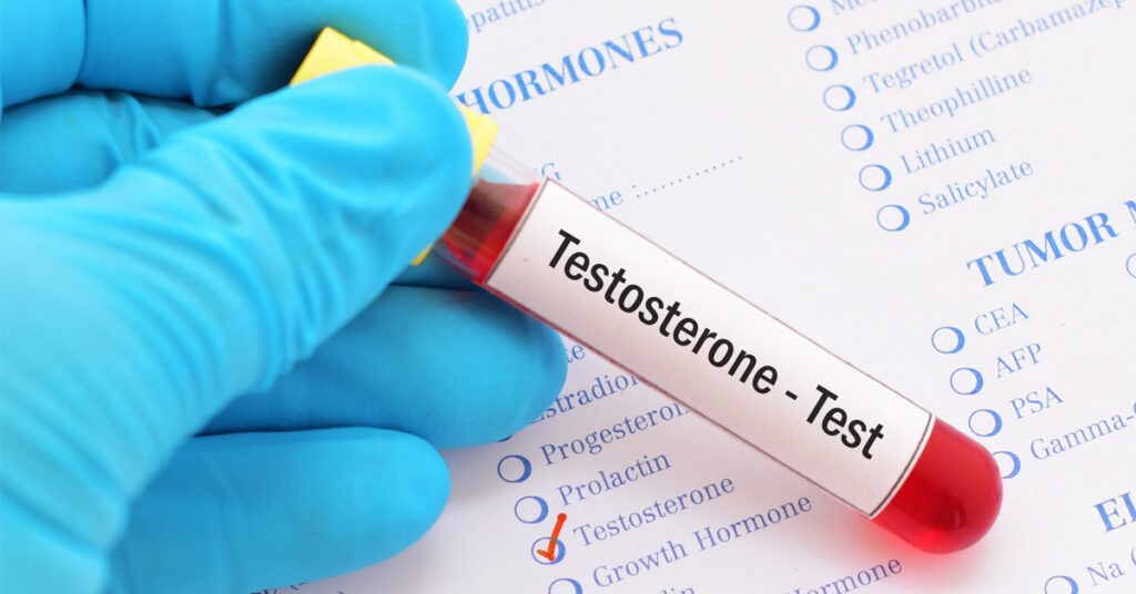 Hidden Truth Behind ‘Normal’ Testosterone | Functional Medicine Insight