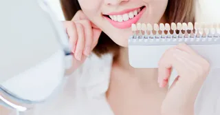 Teeth Whitening in Singapore: In-Clinic vs At-Home vs DIY (What Actually Works)