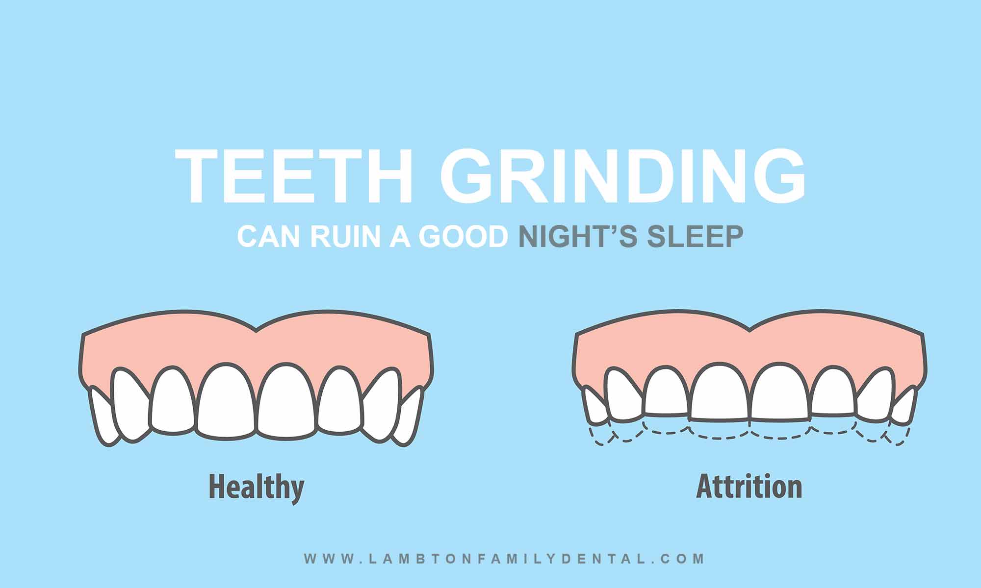 Why Does My Child Grind Their Teeth?