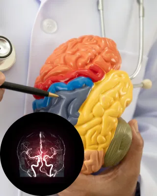 Brain Tumor VA Rating Explained: What Veterans Need to Know