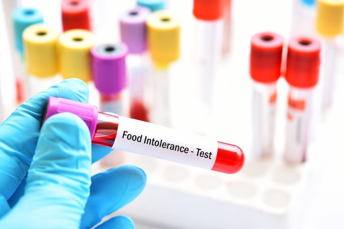 Food Intolerance Testing And Bioenergetic Scanning Ebook
