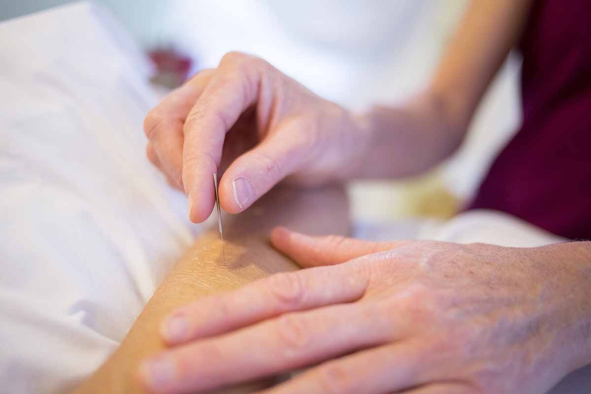 Acupuncture for Neck and Upper Back Pain: An Effective Alternative Treatment