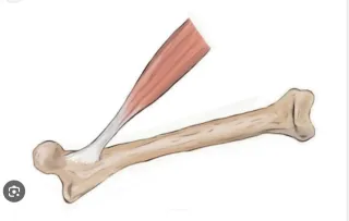 Nobody Thinks About Tendons...Until One Breaks