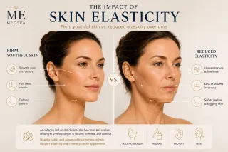 Skin Elasticity: Causes of Loose Skin & How to Support Firmer Skin | ME MEDSPA