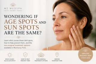 New Age Spots vs Sun Spots: Causes & Treatment Options | ME MEDSPA blog Post