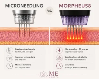 Microneedling vs Morpheus8 | ME MEDSPA