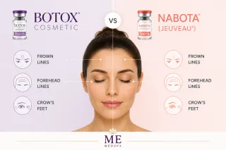 Botox vs Nabota (Jeuveau) for Wrinkles | ME MEDSPA