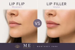 Lip Flip vs Lip Filler | ME MEDSPA Monterey Park
