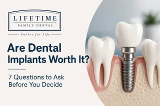 Are Dental Implants Worth It? 7 Questions to Ask Before You Decide