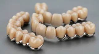 Lost Crown or Filling in Plano? Get Emergency Dental Help