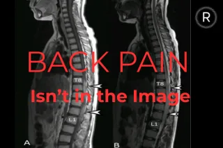 Back Pain and Imaging: Why Pictures Don’t Always Tell the Story